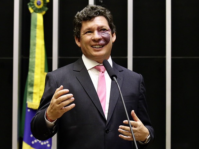 Reginaldo Lopes diz que Reforma passa por fase de diálogo com o ministério da Fazenda. Foto: Divulgação / Câmara dos Deputados